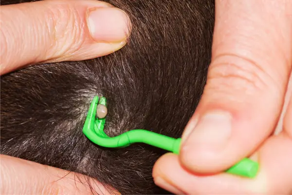 person removing tick from dog